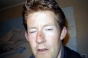 Alex cut nose, General 2000 - Courchevel Enquirer